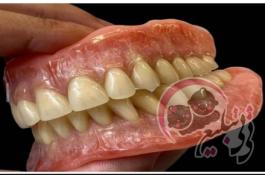 دندانسازی تجربی عسگری